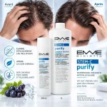 Shampoing Antipelliculaire